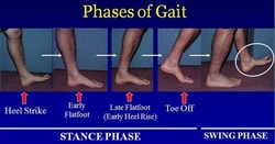 the causes of gait abnormalities