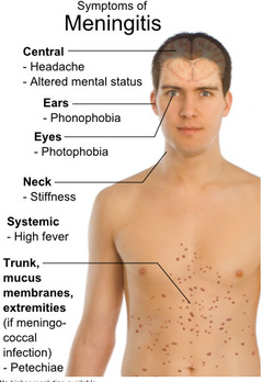 pathology of viral meningitis 