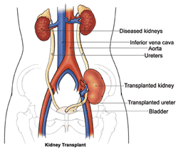 clinical examination of renal transplant