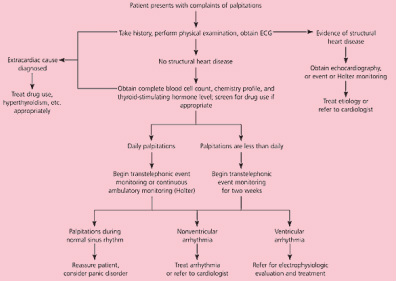 the causes of palpitation