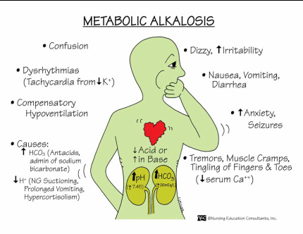 pathology of metabolic alkalosis 