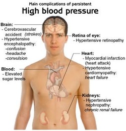 pathology of hypertension