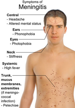 Pathology of bacterial meningitis 