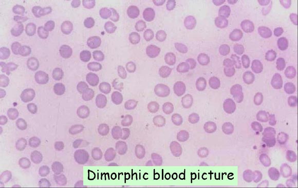 medical zone - dimorphic blood film 
