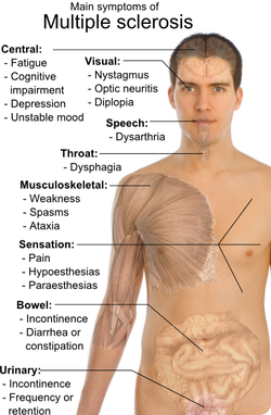 Pathology of multiple sclerosis