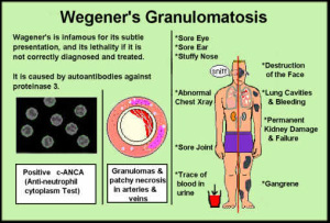 pathology of wegener granulomatosis