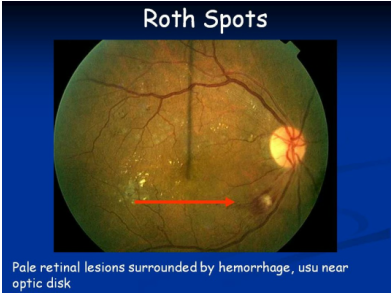 medical zone - roth spots