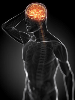 symptom finder - the causes of headache