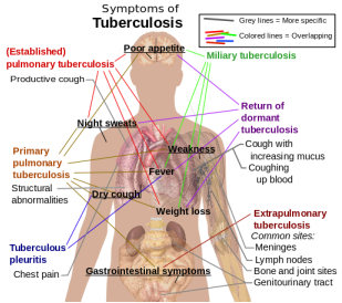 pathology of tuberculosis 